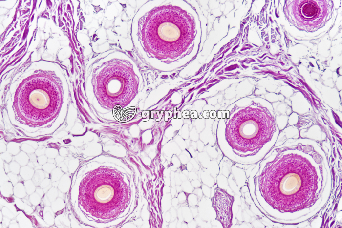 Cuir chevelu en CT x40 - gryphea.com